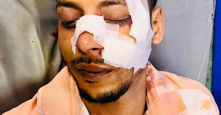 বিশ্বনাথে মিছিলে যোগ দিতে এসে সড়ক দুর্ঘটনায় যুবদল নেতা আহত